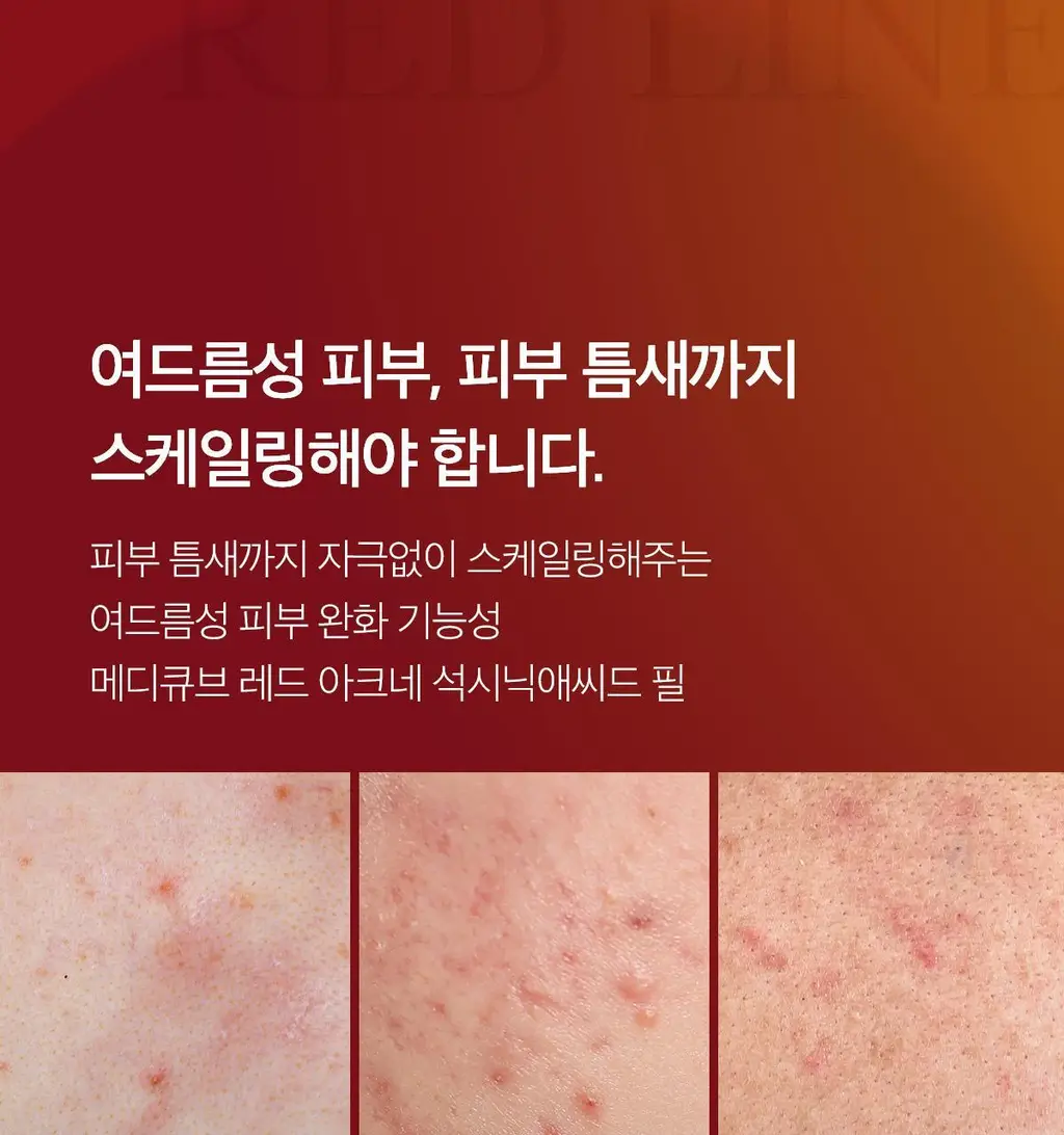 [NEW/여드름성 피부 완화 기능성] 메디큐브 레드 아크네 석시닉 애씨드 필 40g 상세페이지 2